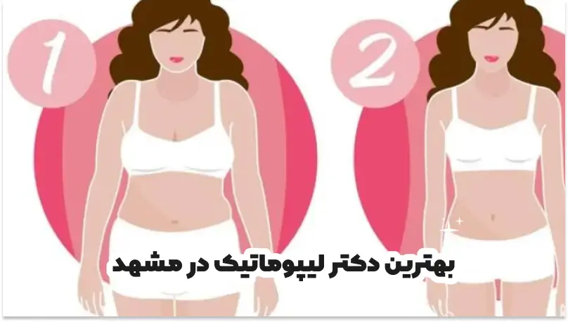 بهترین دکتر لیپوماتیک در مشهد