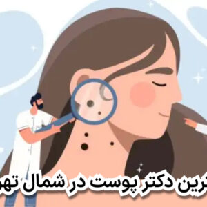 بهترین دکتر پوست در شمال تهران