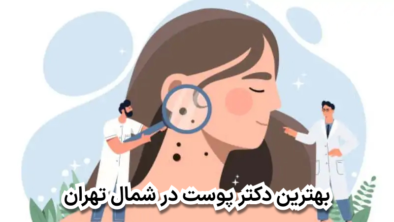 بهترین دکتر پوست در شمال تهران