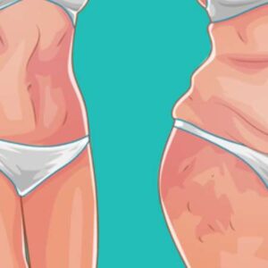 بهترین دکتر پیکرتراشی شکم در شیراز