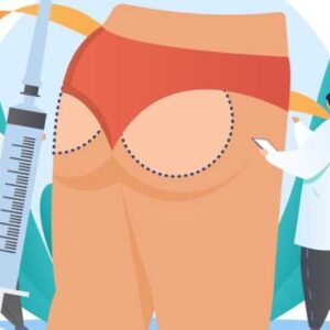 بهترین دکتر لیفت باسن در شیراز