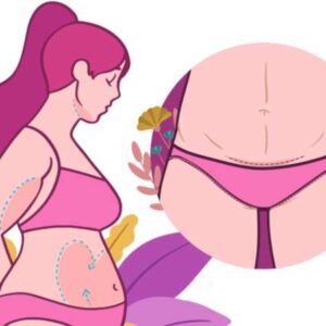 بهترین دکتر پیکرتراشی شکم در تبریز