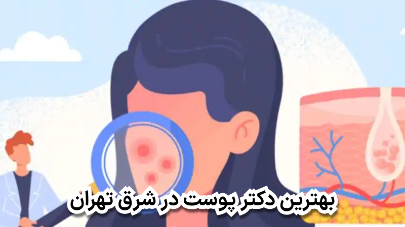 بهترین دکتر پوست در شرق تهران