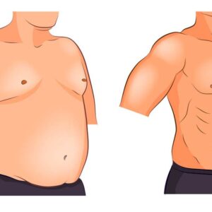 بهترین دکتر پیکرتراشی آقایان در شیراز