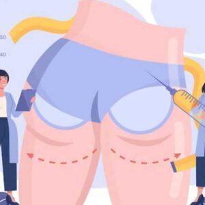 بهترین دکتر لیفت باسن در تبریز