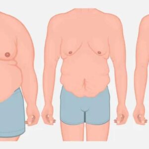 بهترین دکتر پیکرتراشی آقایان در تبریز