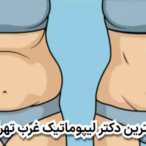 بهترین دکتر لیپوماتیک شرق تهران