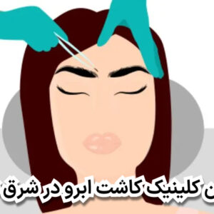 بهترین کلینیک کاشت ابرو در شرق تهران
