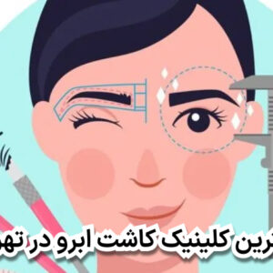 بهترین کلینیک کاشت ابرو در تهران