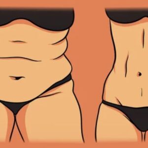 بهترین دکتر لیفت شکم در اهواز