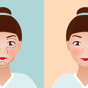 بهترین جراح پلاستیک در کرج