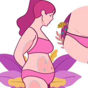 بهترین دکتر لیفت شکم در اراک