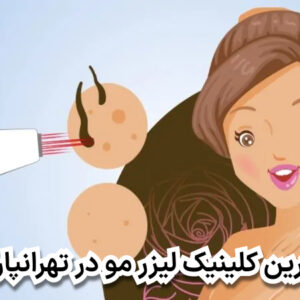 بهترین کلینیک لیزر مو در تهرانپارس