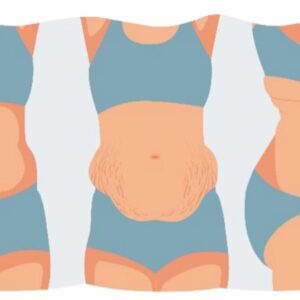 بهترین دکتر لیپوماتیک در همدان