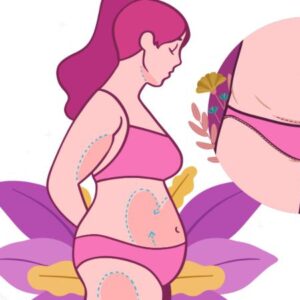 بهترین دکتر ابدومینوپلاستی در خرم آباد