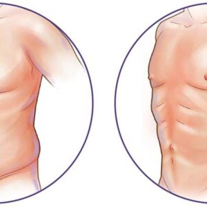 بهترین دکتر پیکرتراشی در رشت