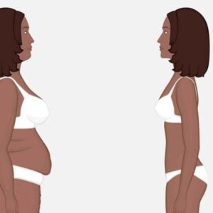 بهترین دکتر لیپوماتیک کاشان