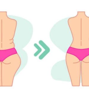 بهترین جراح لیپوماتیک باسن غرب تهران