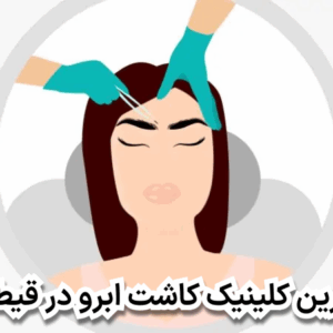 بهترین کلینیک کاشت ابرو در قیطریه