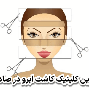 بهترین کلینیک کاشت ابرو در صادقیه