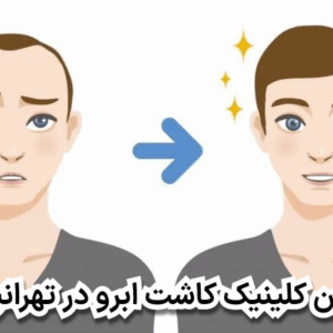 بهترین کلینیک کاشت ابرو در تهرانپارس