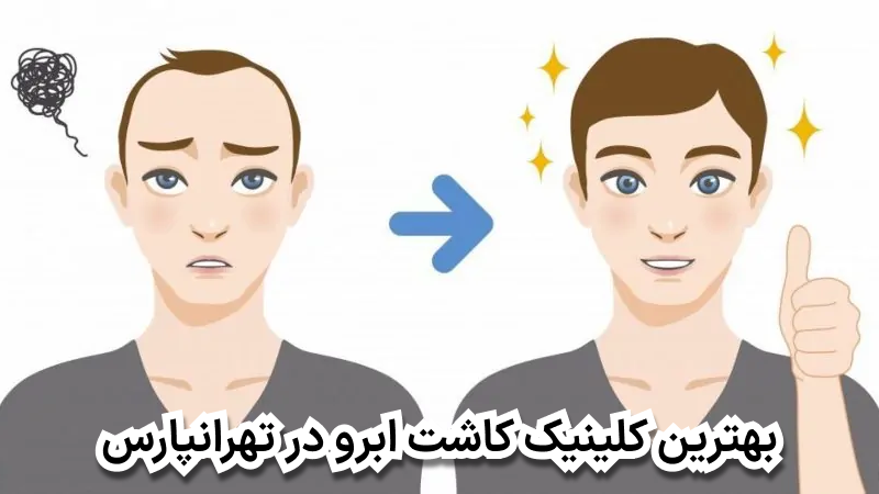 بهترین کلینیک کاشت ابرو در تهرانپارس