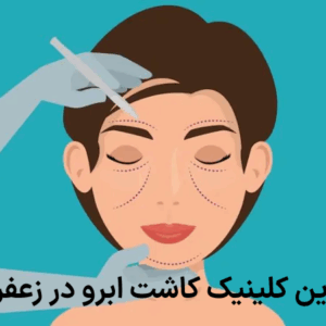 بهترین کلینیک کاشت ابرو در زعفرانیه