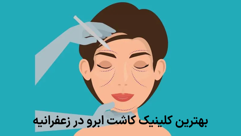 بهترین کلینیک کاشت ابرو در زعفرانیه