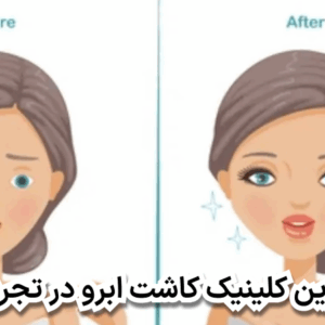 بهترین کلینیک کاشت ابرو در تجریش