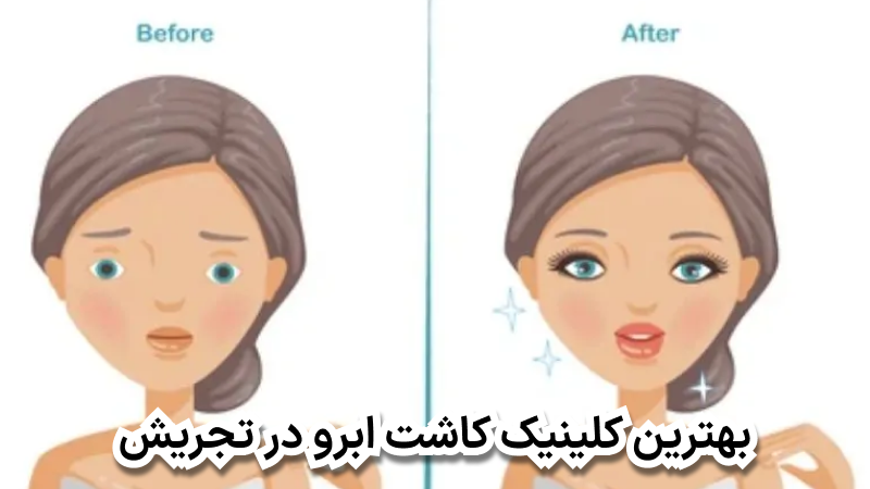 بهترین کلینیک کاشت ابرو در تجریش