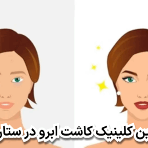 بهترین کلینیک کاشت ابرو در ستارخان
