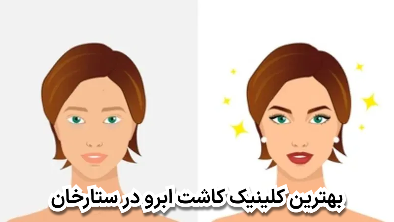 بهترین کلینیک کاشت ابرو در ستارخان
