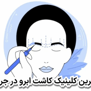 بهترین کلینیک کاشت ابرو در جردن