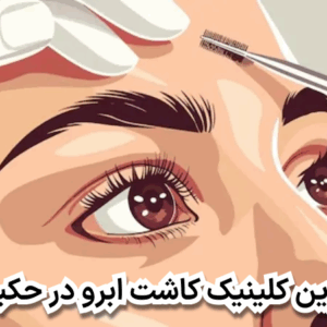 بهترین کلینیک کاشت ابرو در حکیمیه
